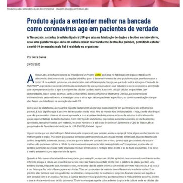 Produto ajuda a entender melhor na bancada como coronavírus age em paciente de verdade – Jornal da USP