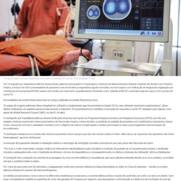 Tecnologia brasileira reduz uso de pulmão artificial em paciente grave – Esplanada News