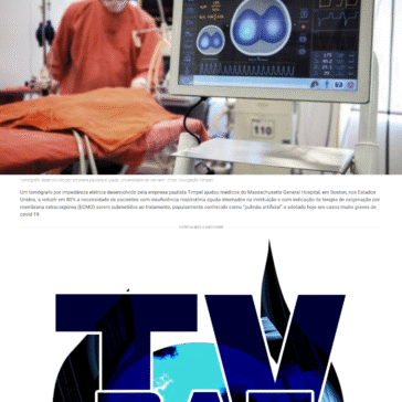 Tecnologia brasileira reduz uso de pulmão artificial em paciente grave – Portal Agora Notícias