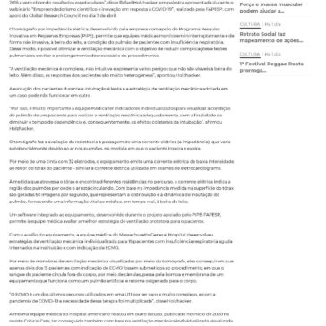 Tecnologia brasileira reduz em 80% o uso de `pulmão artificial` – São Paulo FM