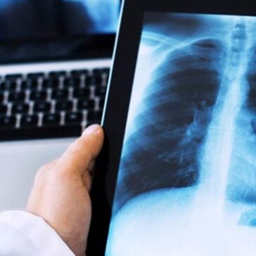 Transformação digital na radiologia traz mais eficácia na jornada do paciente